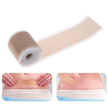 FabHeal™ Scar Repair Silicone Strips - Fab Alchemy