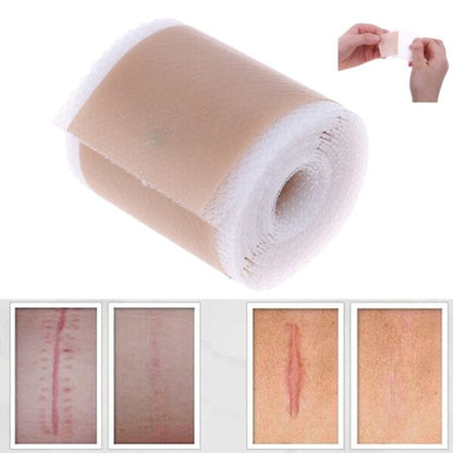 FabHeal™ Scar Repair Silicone Strips - Fab Alchemy