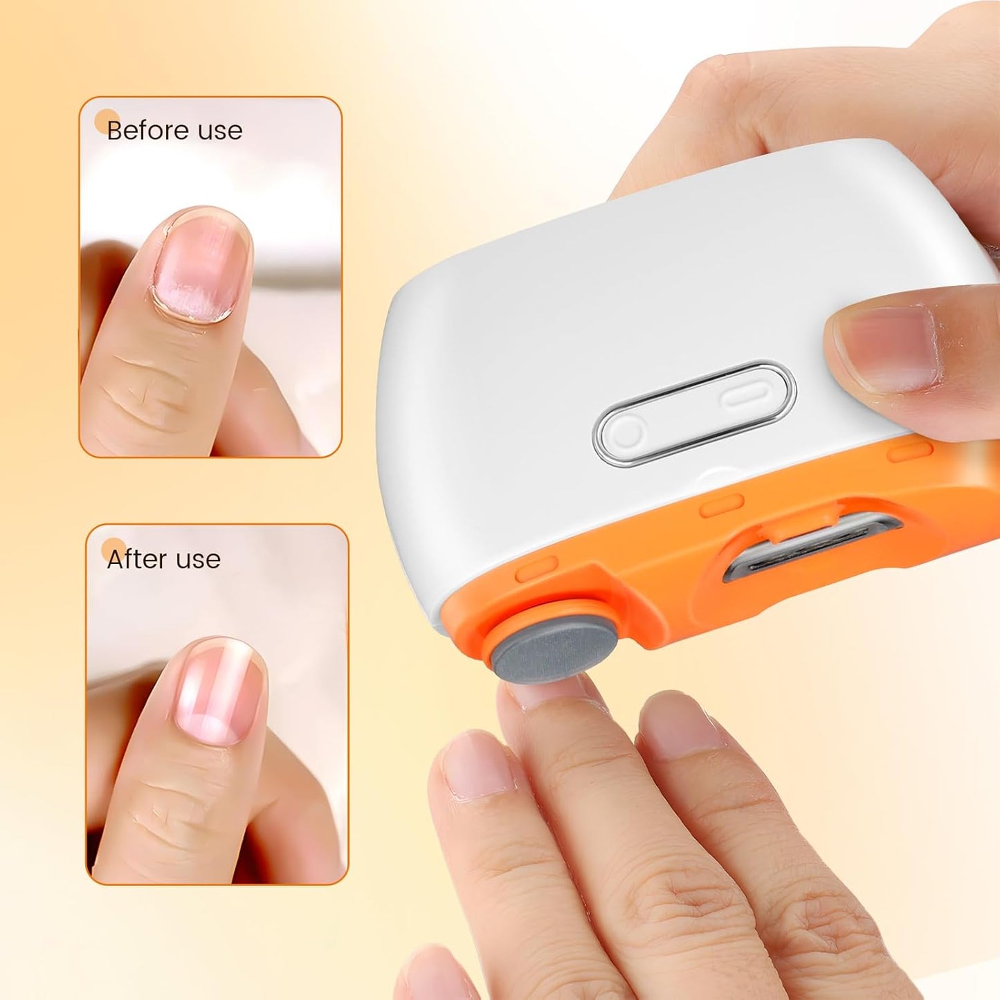 FabTrim™ 2-in-1 Electric Nail Clipper