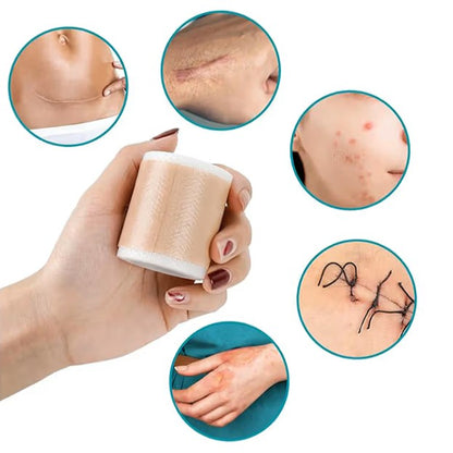 FabHeal™ Scar Repair Silicone Strips - Fab Alchemy